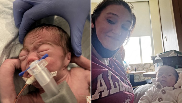 Mayron Hollis' daughter Elayna weighed one pound and 12 ounces when she was a newborn, left.