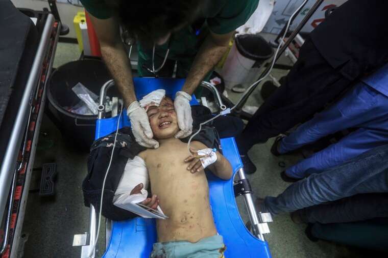 A wounded Palestinian child receives medical attention in Khan Younis in southern Gaza.