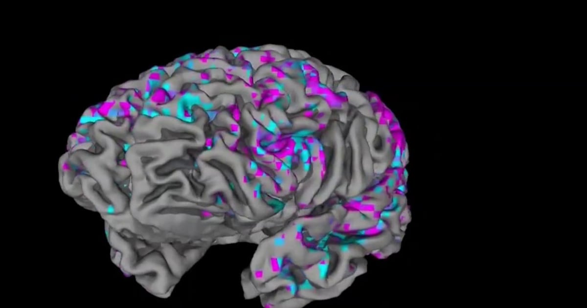 Artificial intelligence study decodes brain activity into diaglogue