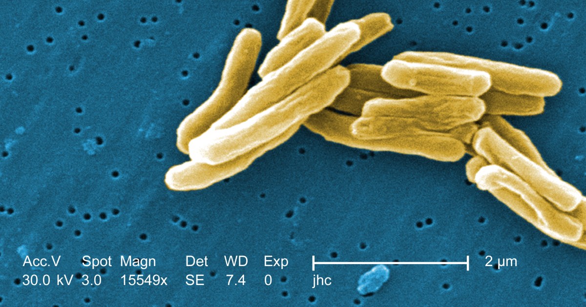 Woman who refused tuberculosis treatment is in custody months after an arrest warrant was issued