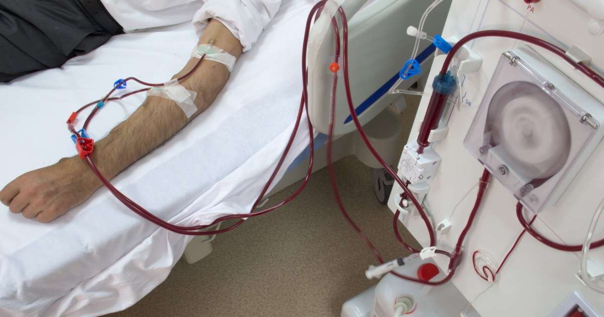 New heart syndrome identifies link among obesity, diabetes and kidney disease