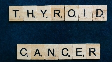 Hypothyroidism: Symptoms, Causes, Treatment & Medication