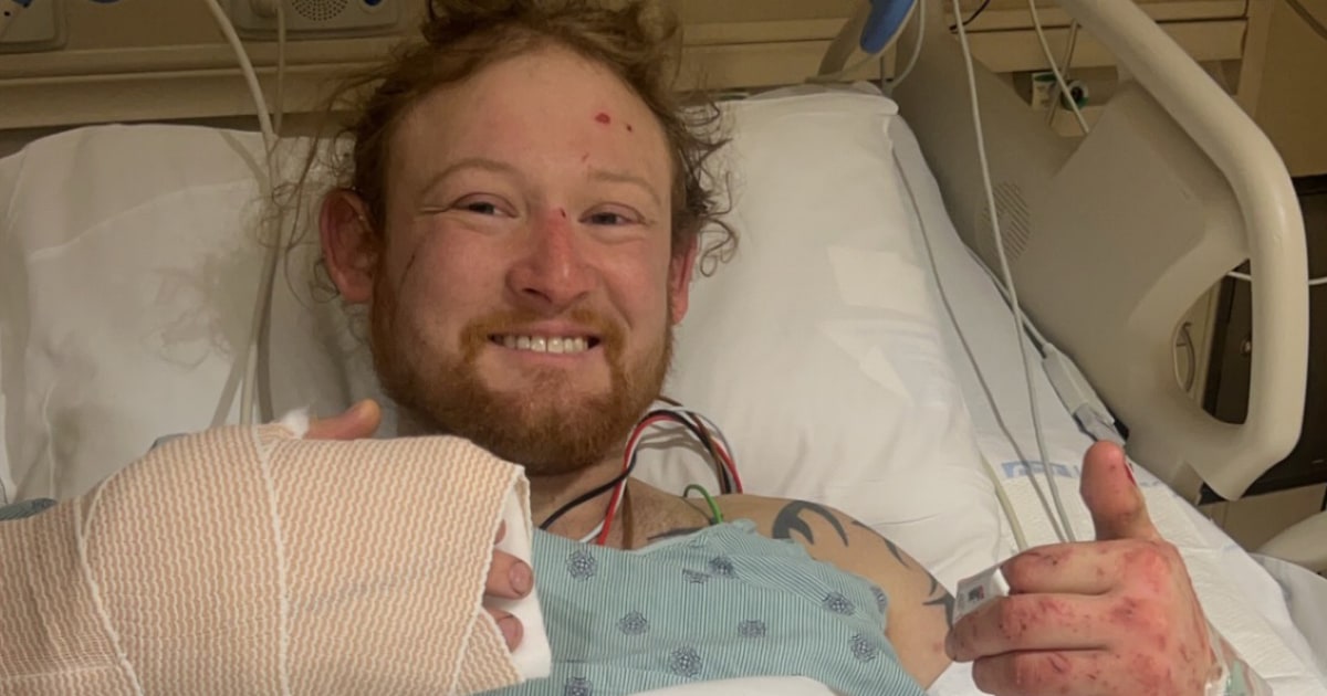 Man who lost a leg after being stuck in a mangled car for days thanks the kindness of strangers