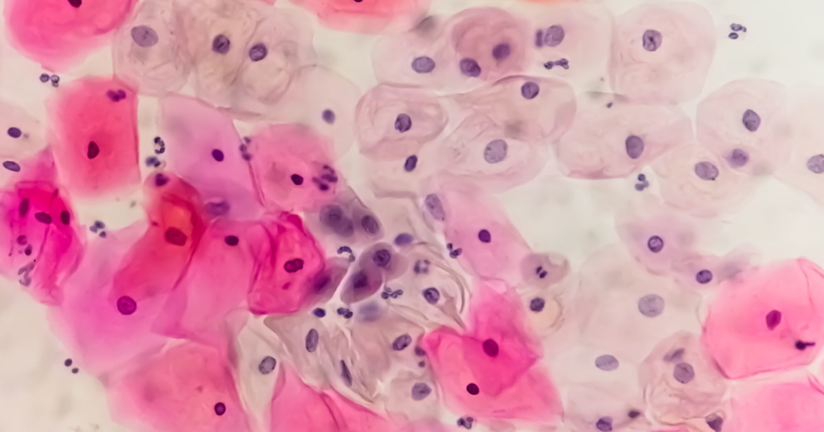 A little too old for HPV vaccine? Cervical cancer rising among women in their 30s and 40s