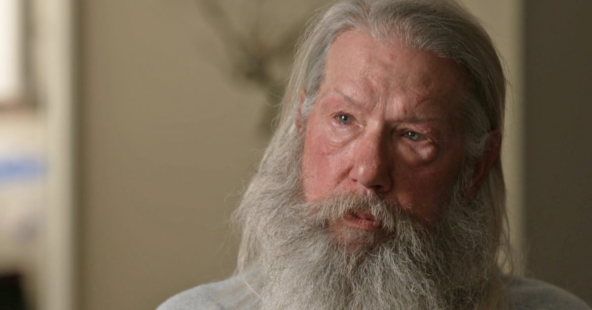 Bite mark analysis has no basis in science, experts now say. Why is it still being used in court?