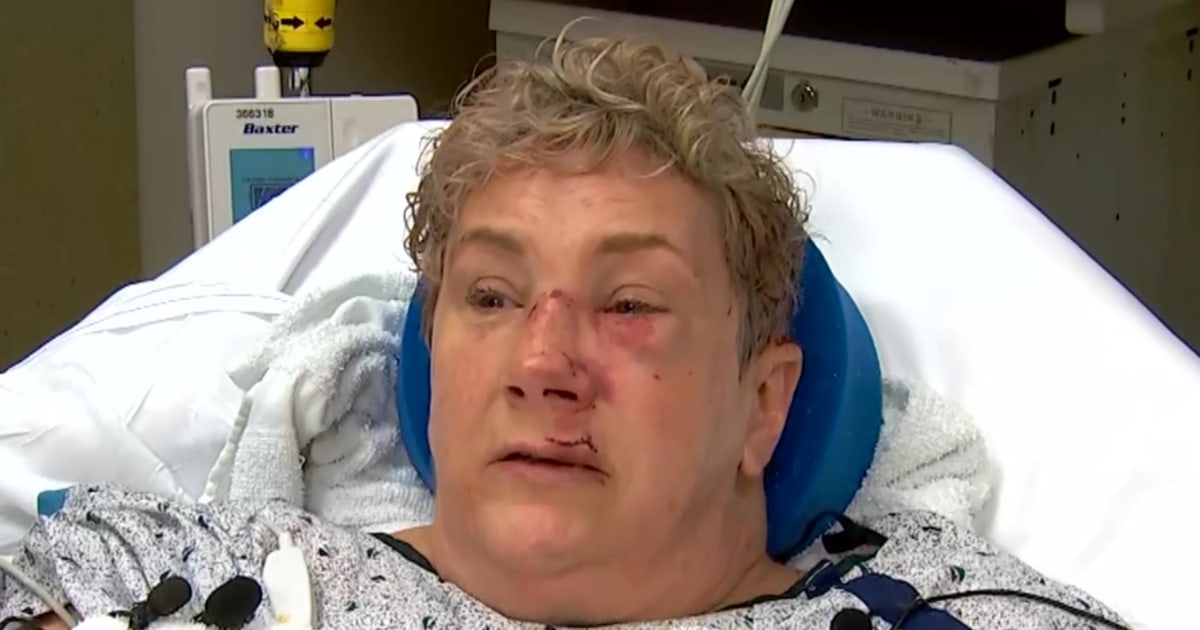 Pennsylvania woman saw a bear jump a fence before it attacked and thought, 'This is it — I’m going to die'